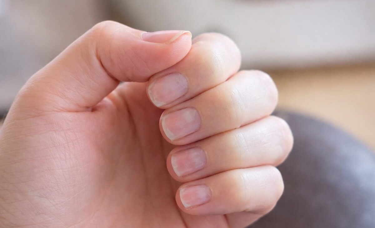 Ногти после снятия гель-лака крупным планом &mdash; естественное состояние и лёгкие неровности пластины