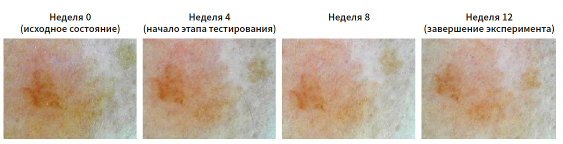 Турубара (Виши) КМ 2-2025_Рис 5.png