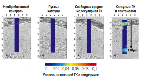 Hyalu B5(LRP) KM 4-2025_Fig 3.png