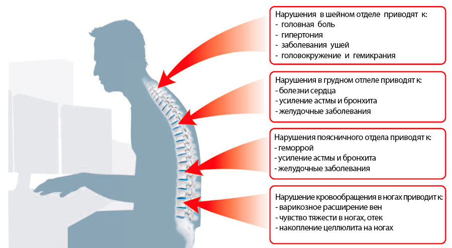 Нарушения в различных отделах позвоночника при неправильном сидении