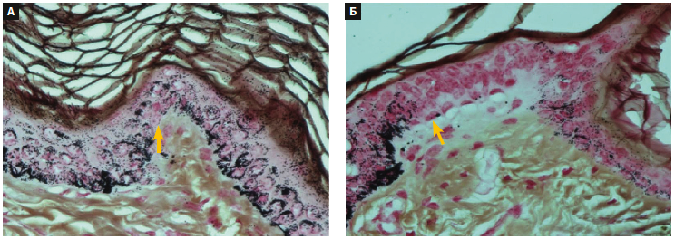 Ромашкина (Глатион)м КМ 1-2026_Рис 3.png