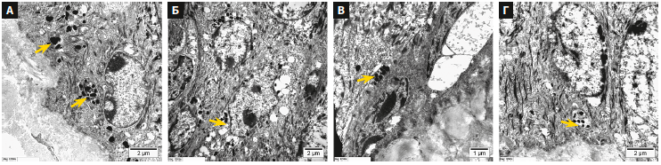 Ромашкина (Глатион)м КМ 1-2026_Рис 4.png