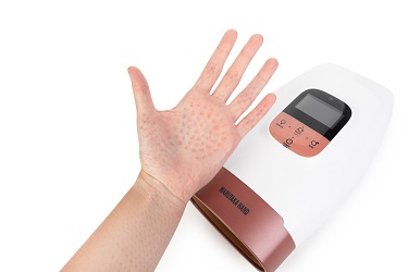 Акупунктурный массаж рук Акупунктурный массаж рук