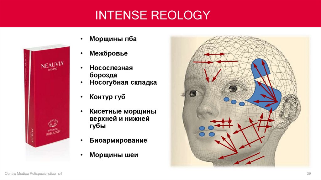 Neauvia Intense Rheology