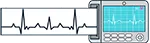 EKG