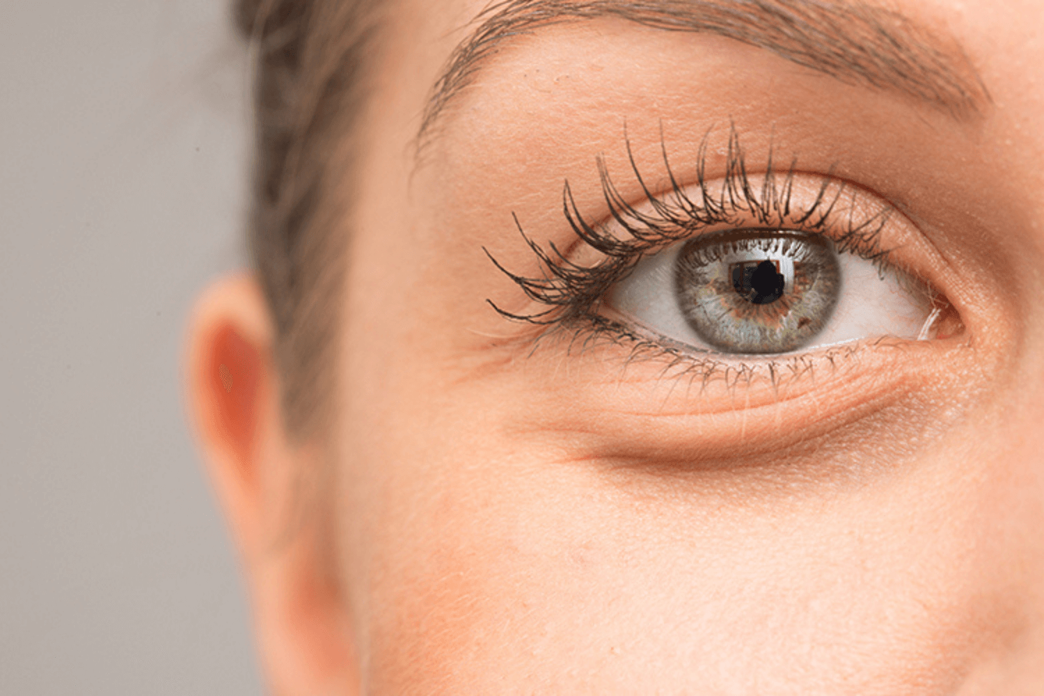 Морщины вокруг глаз: самые эффективные средства, чтобы их убрать