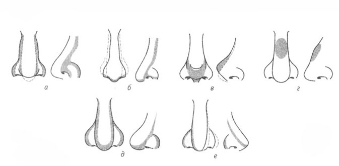 Как нарисовать нос курносый нос