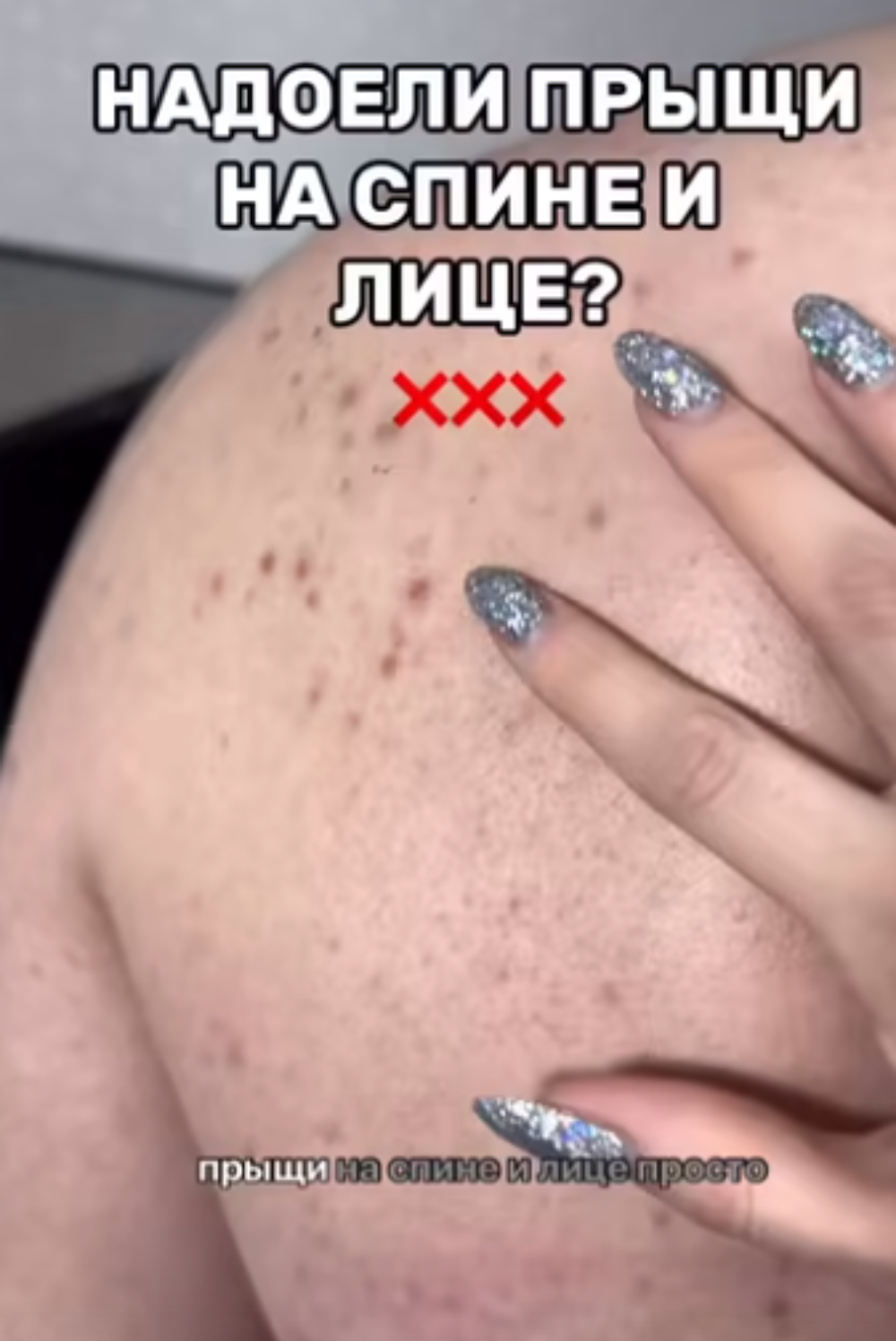 Тоник для кожи с цинком