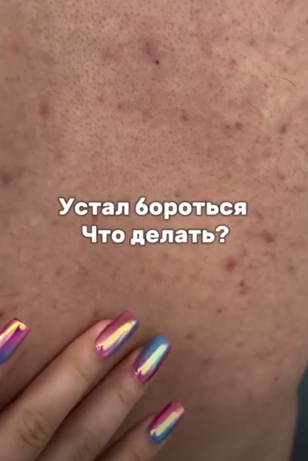 Тоник для кожи с цинком