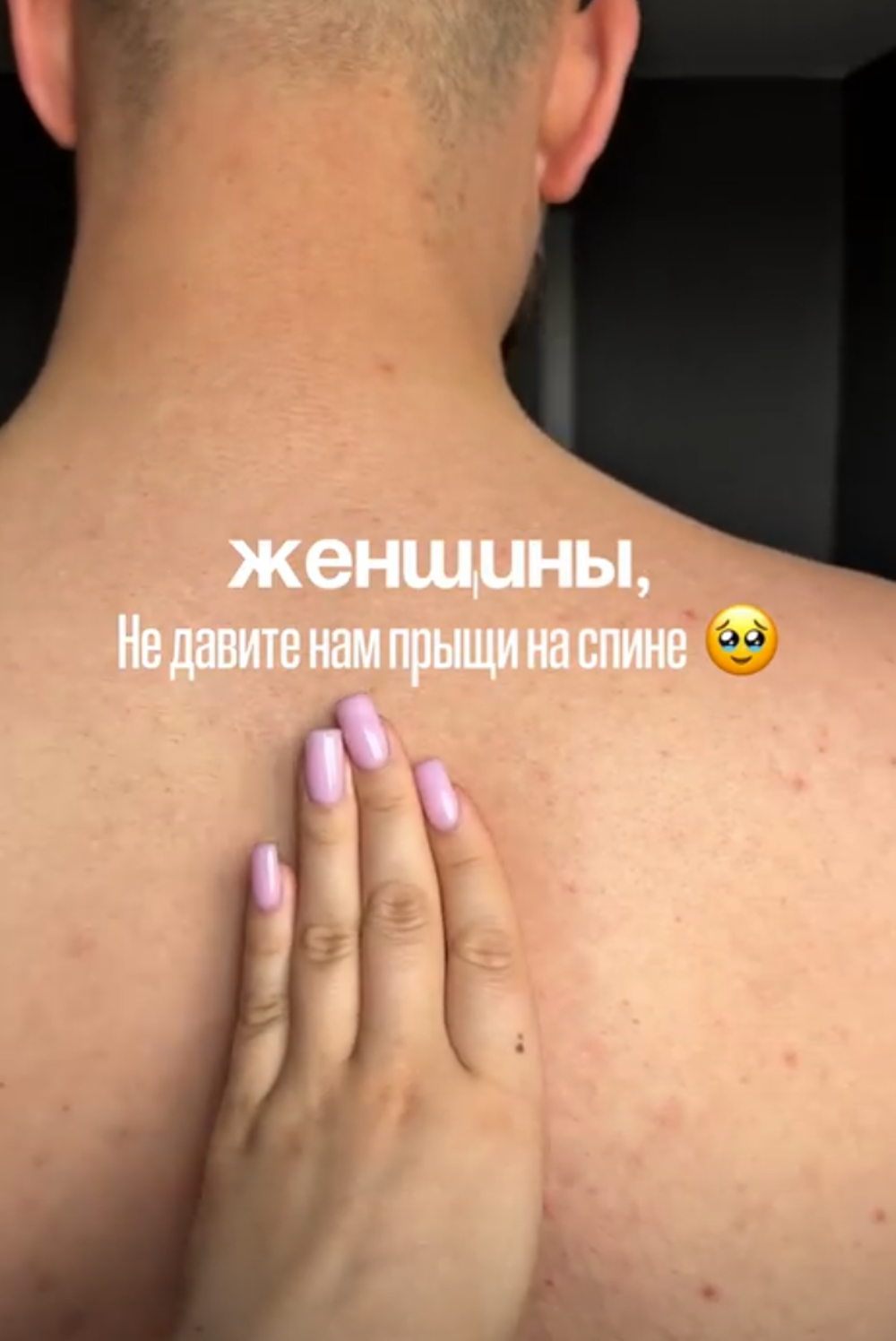 Тоник для кожи с цинком