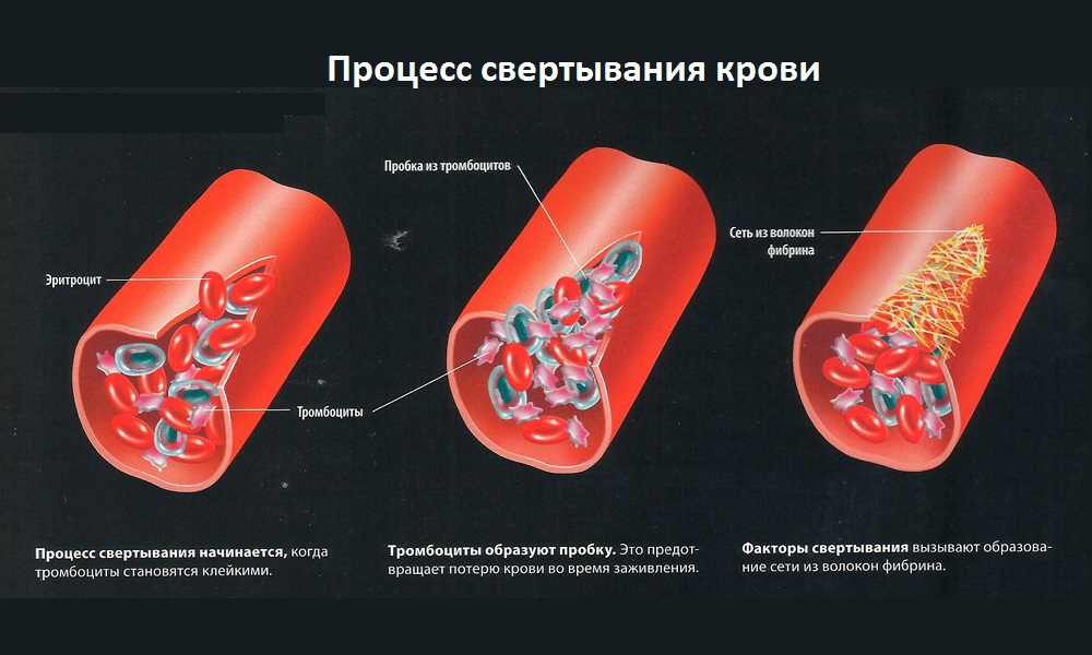 схема процесса свертываемости крови