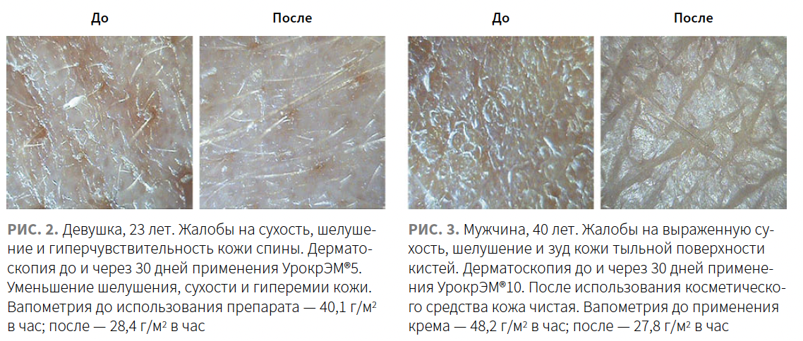 Butareva (Retinoidy) KM 4-2023_Fig 2-3.png