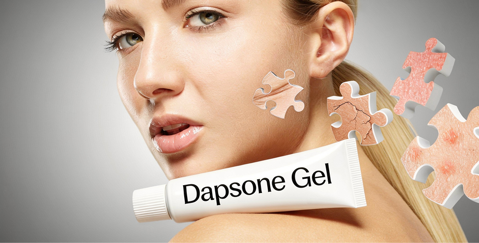 Dapsone and acne_1000x500.jpg