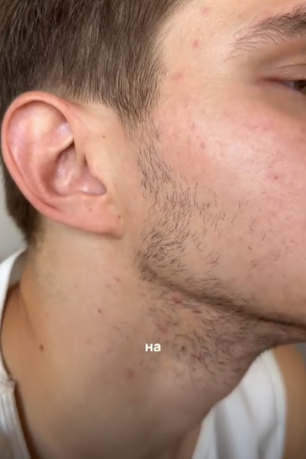 Многофункциональный триммер для волос 5 в 1