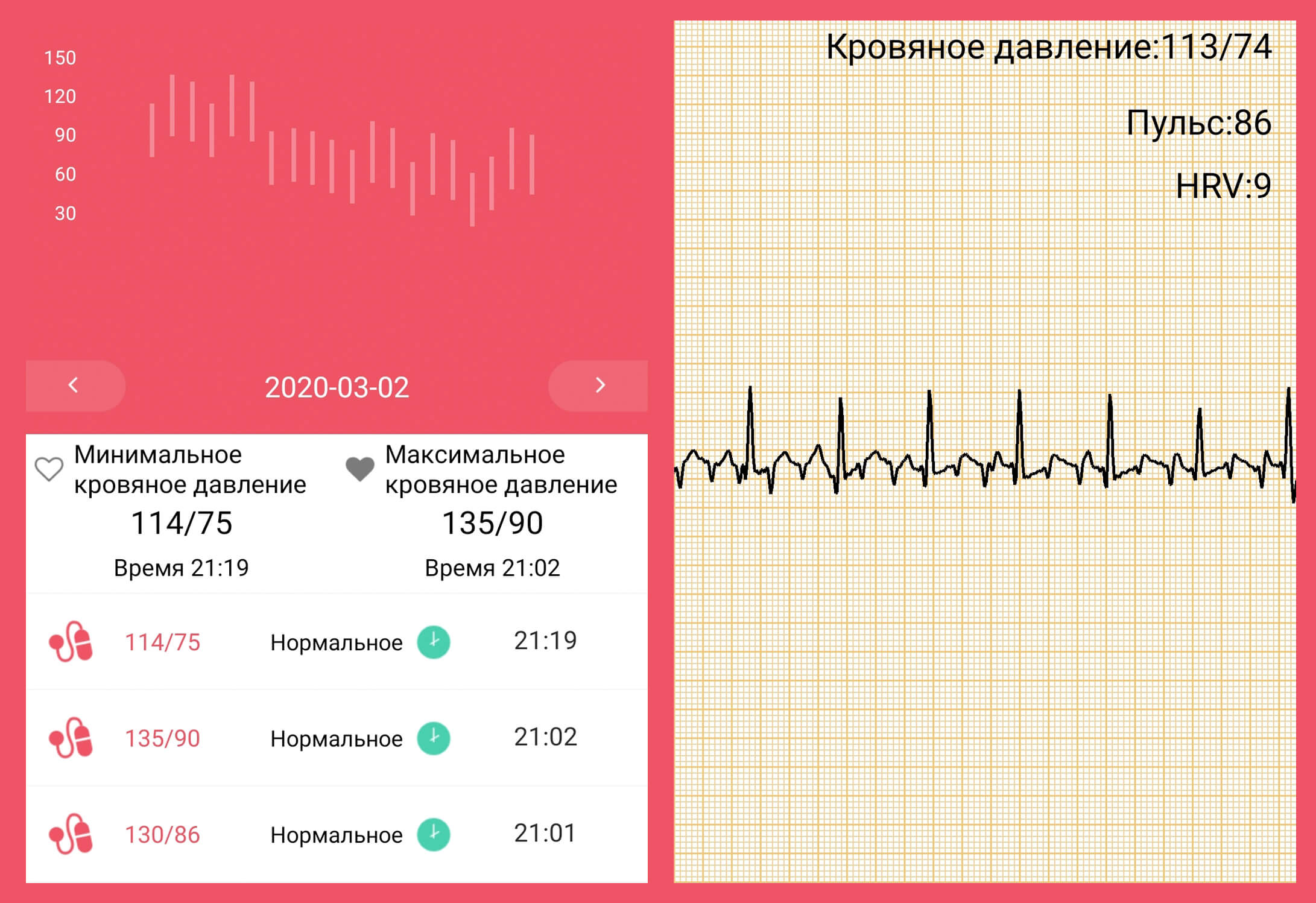 Пульс при измерении давления