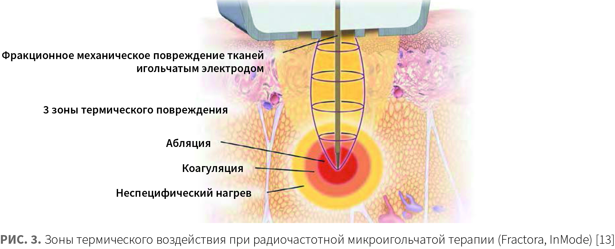 Лешунов (КИТ МЕД) КМ 3-2024_Рис 3.jpg