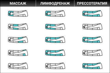 Надув камер в режимах массаж, лимфодренаж и прессотерапия