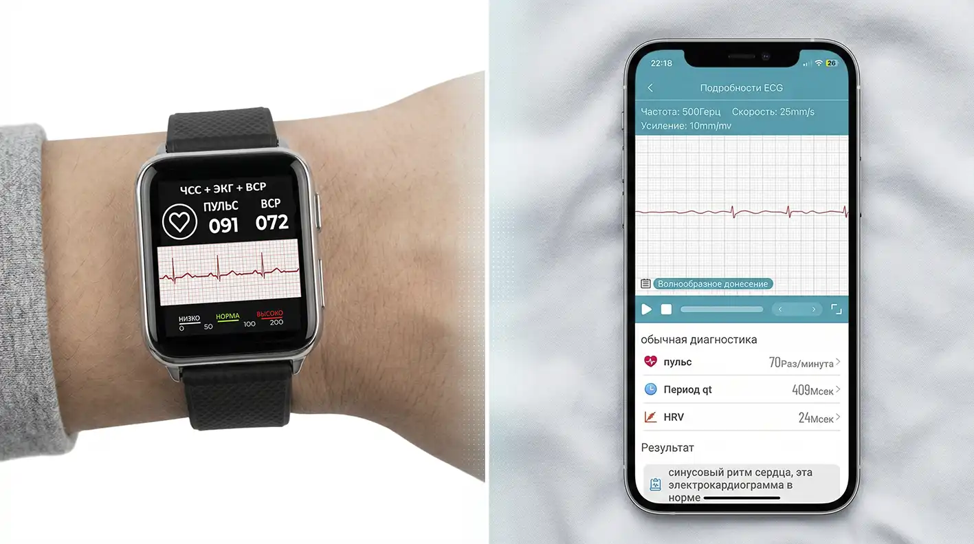 Самоконтроль и мониторинг сердца