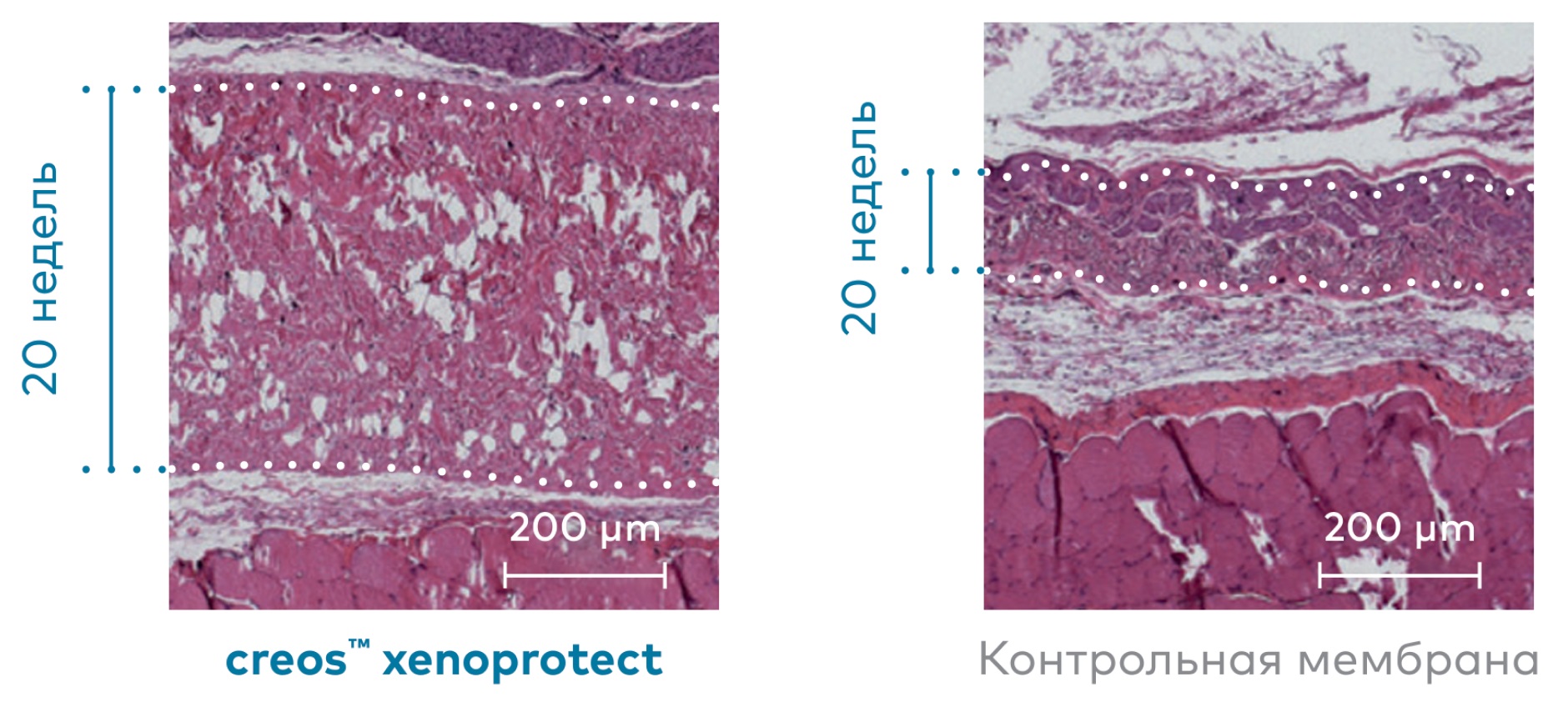 Устойчивость Creos Xenoprotect к резорбции.jpg