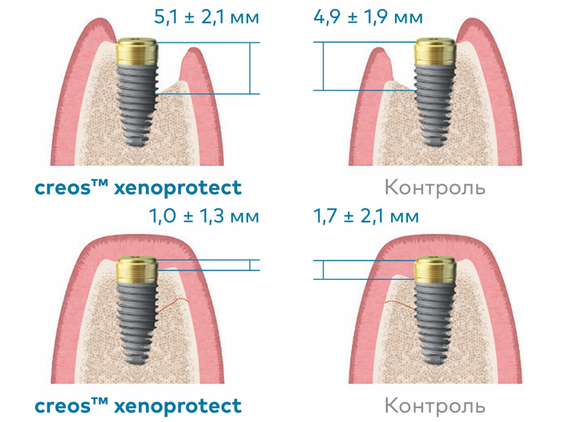 Влияние Creos Xenoprotect на формирование кости.jpg