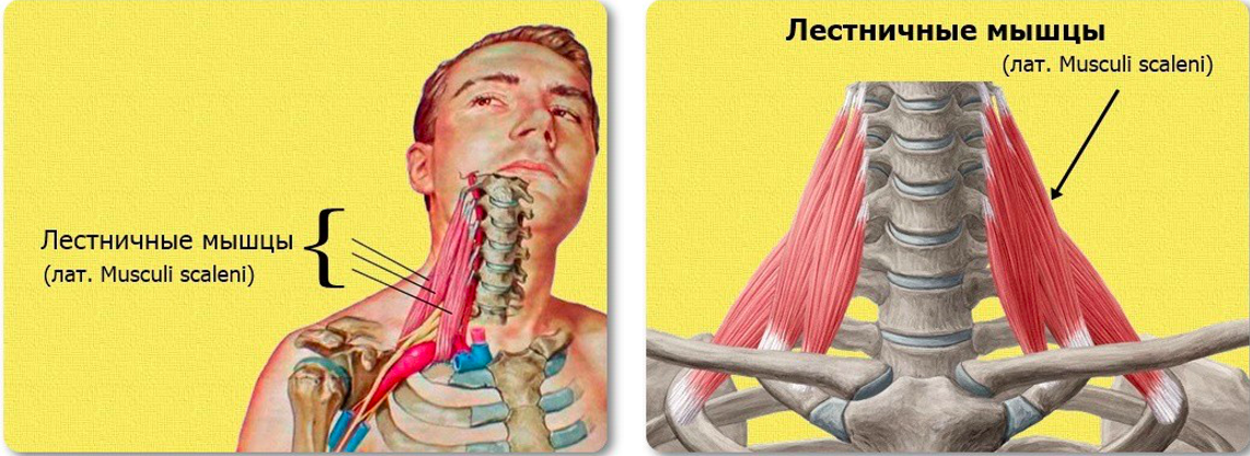 Симптом лестничной мышцы. Передняя лестничная мышца анатомия. Синдром лестничных мышц шеи. Лестничные мышцы шеи анатомия. Передняя лестничная мышца шеи.