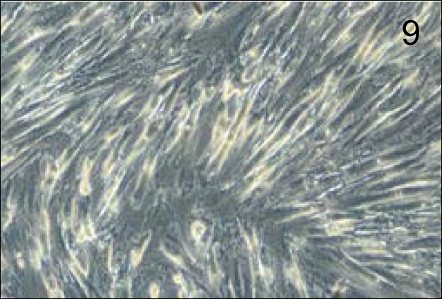 9 Фибробласты на поверхности адгезивного планшета (7-е сутки культивирования, фазовый контраст, увел ×100).png