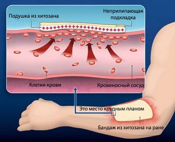 Как работает гемостатик на основе хитозана