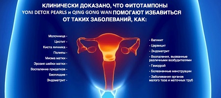 Фитотампоны Yoni Detox Pearls и Qing Gong Wan помогают 450х200.jpg