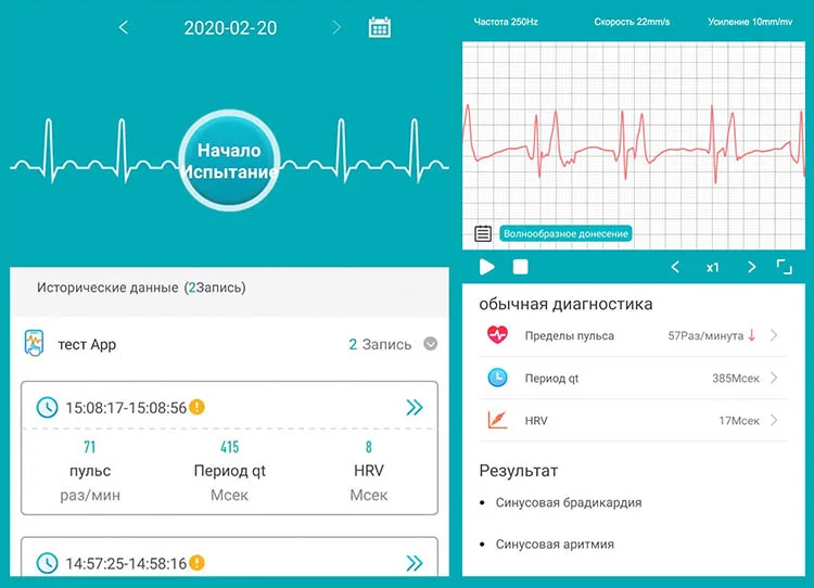 snyatie-kardiogrammy-healthband-pro-10