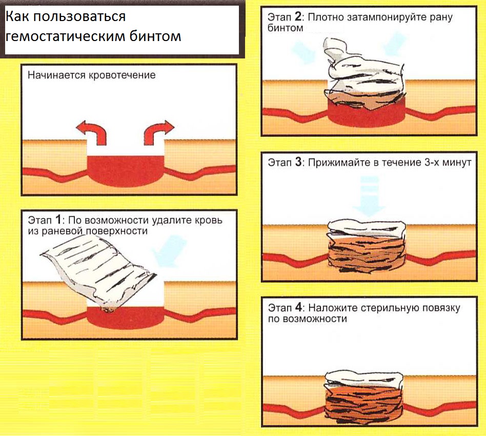 инструкция по использованию гемостатического бинта-повязки