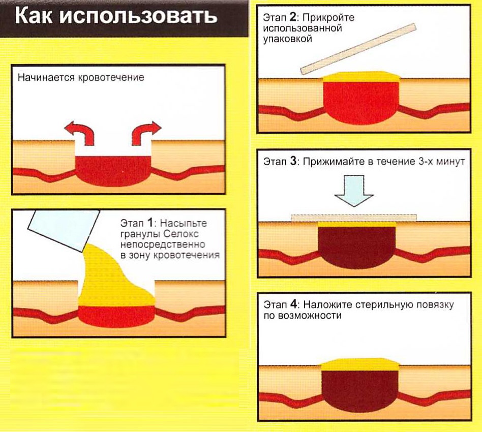 инструкция как использовать гемостатические гранулы