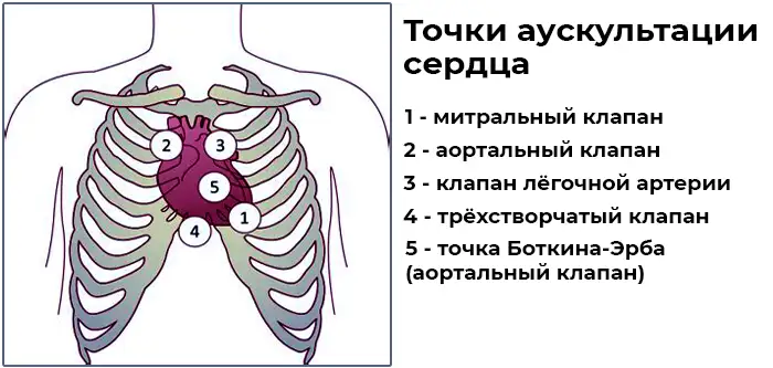 Точки аускультации