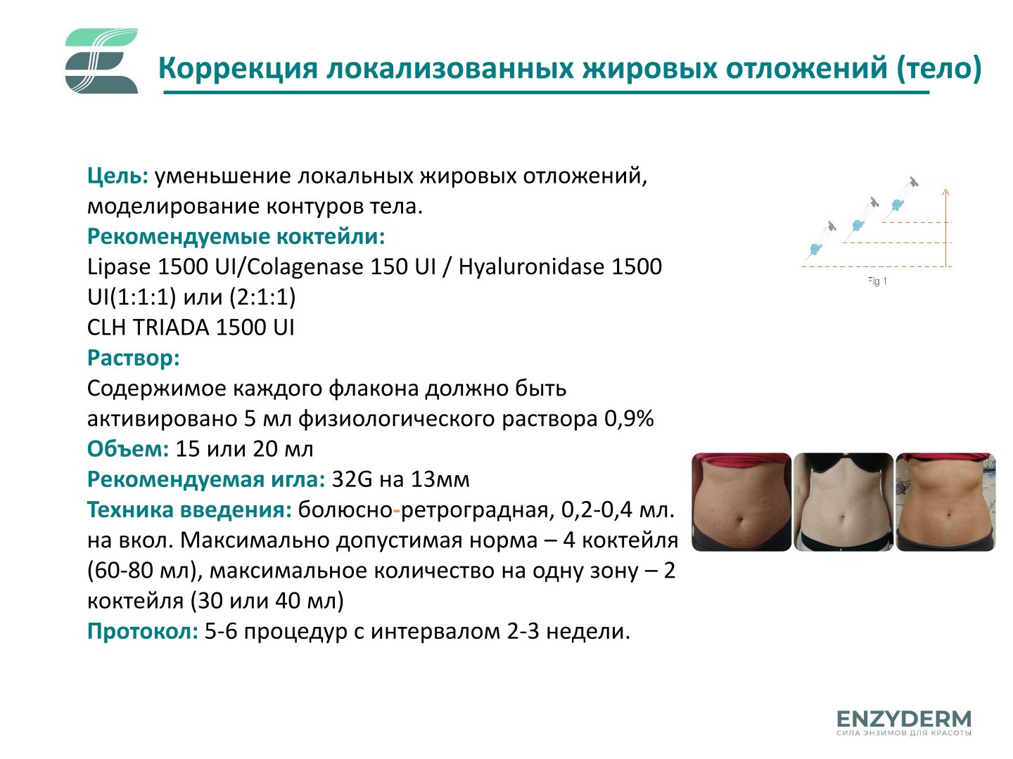 Lipase 1500 UI Enzyderm | Липаза