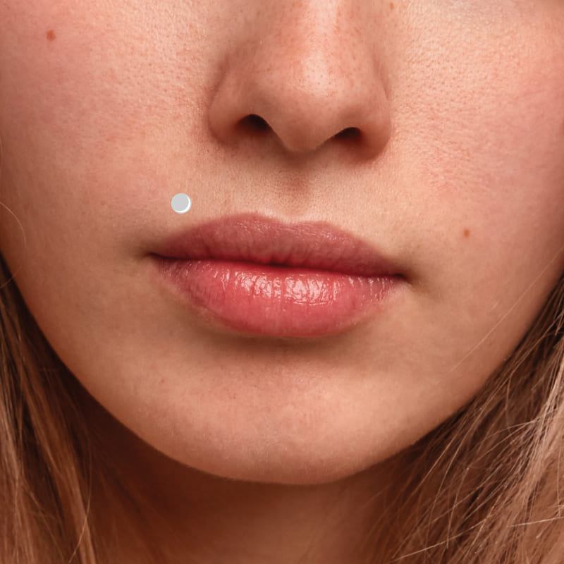 Как снять отек после увеличения губ гиалуроновой кислотой - блог Cleo Line