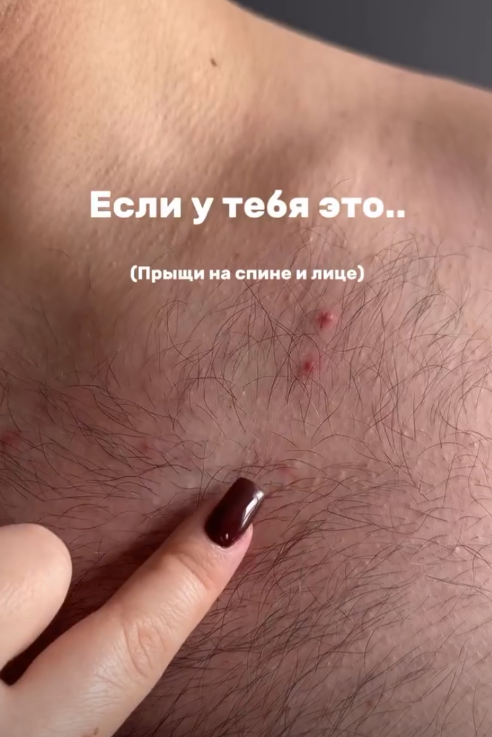 Тоник для кожи с цинком