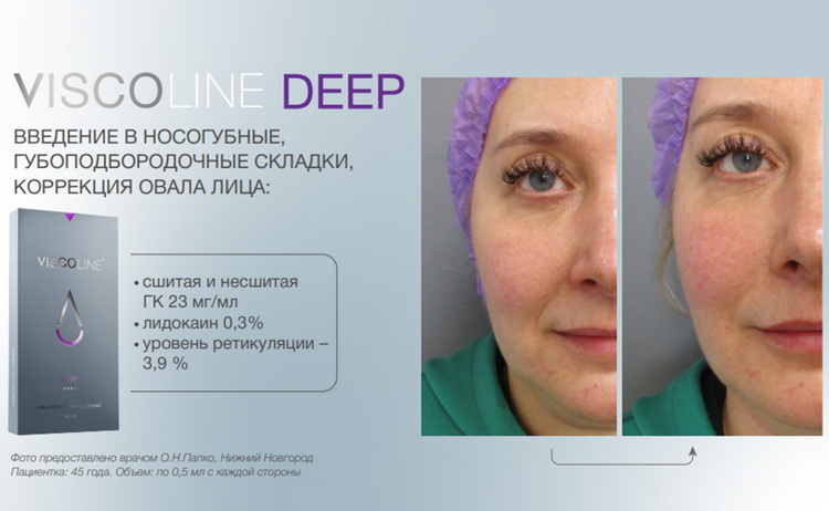 Viscoline® Deep_Висколайн Дип_2 Viscoline® Deep_Висколайн Дип_2.jpg