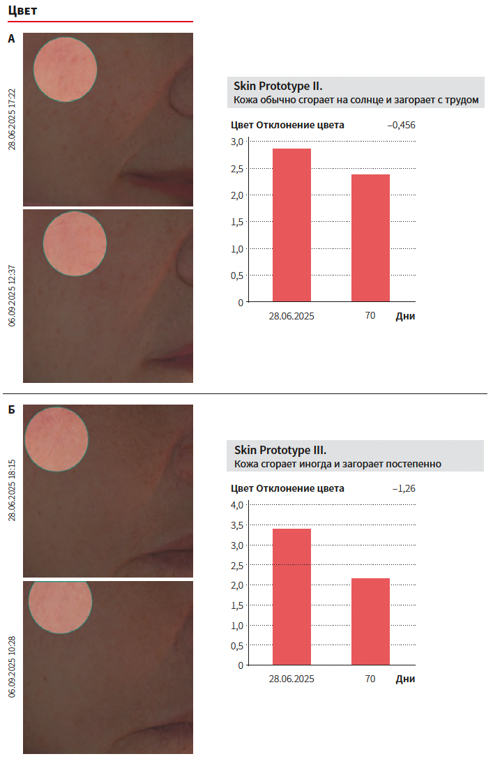 Юсова (Сигма Лаб) КМ 4-2025_Рис 1.png
