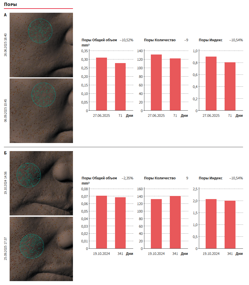 Юсова (Сигма Лаб) КМ 4-2025_Рис 2.png