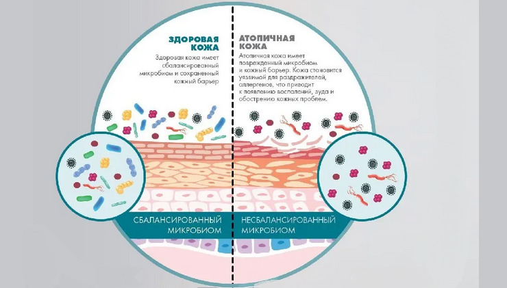 Микроорганизмы, обитающие на коже