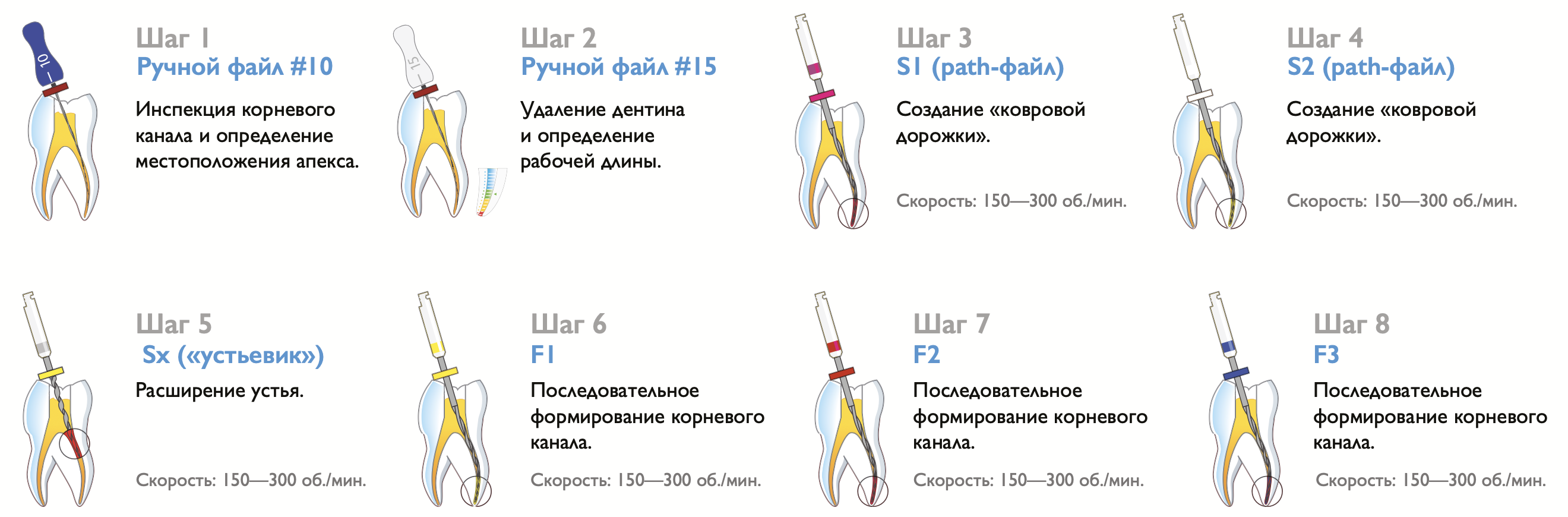 Протейперы Soco Super Files для вторичного эндо - протокол работы