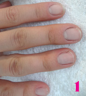 Биоармирование ногтей с помощью системы Royal French - шаг 1