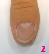 bioarmir202.jpgБиоармирование ногтей с помощью системы Royal French - шаг 2