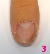 bioarmir203.jpgБиоармирование ногтей с помощью системы Royal French - шаг 3