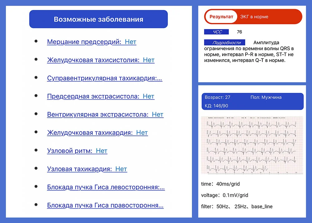 Biomer-BT68-rasshifrovka-ekg