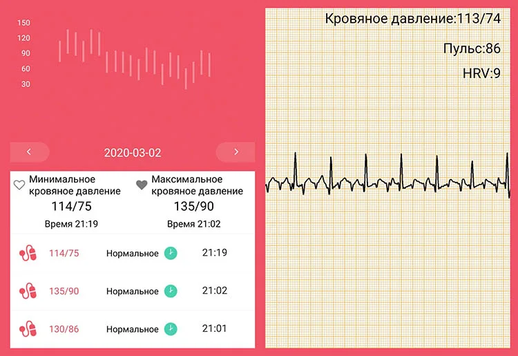 izmerenie-davleniya-biomer-bt68