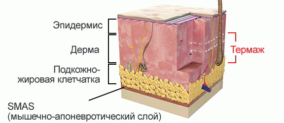 СМАС-лифтинг-слой.jpg