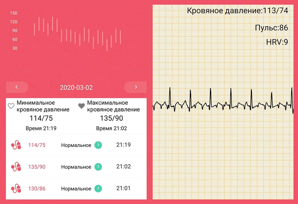 Браслет измерение экг пульса давления