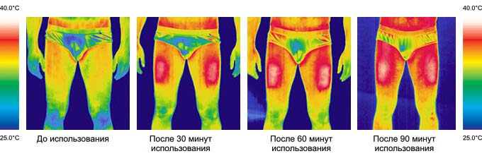 Тепловизионная съемка кальсон с подогревом RedLaika во времени