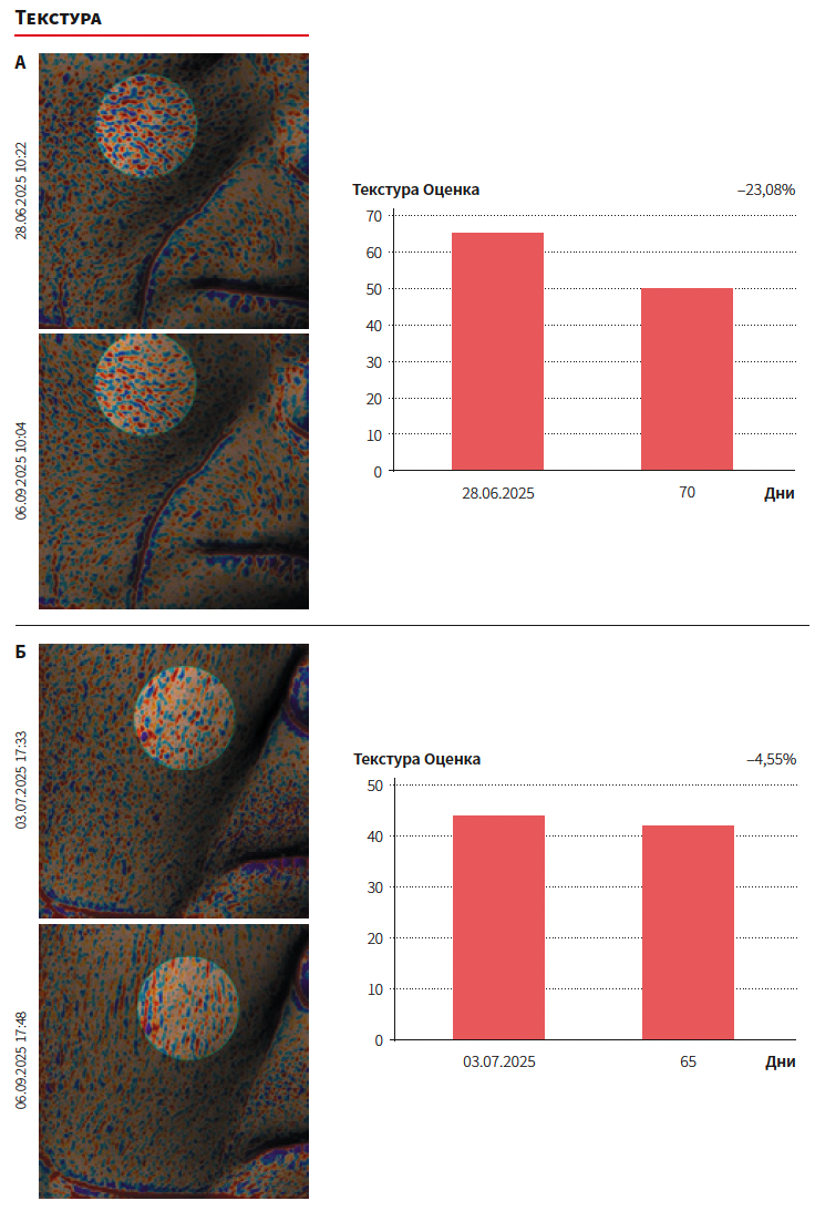 Юсова (Сигма Лаб) КМ 4-2025_Рис 3.png