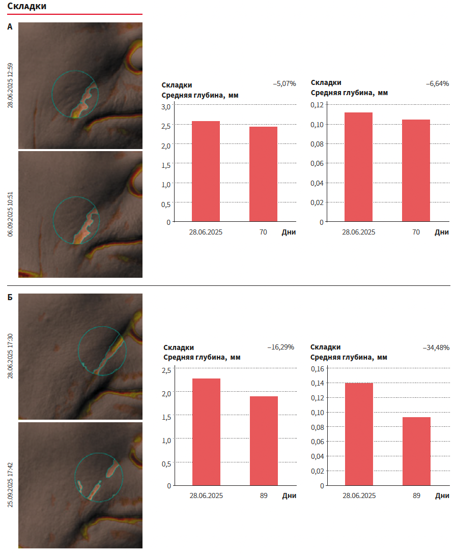Юсова (Сигма Лаб) КМ 4-2025_Рис 4.png